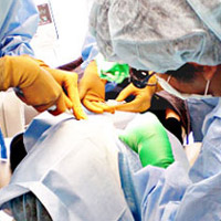 インプラント 手術