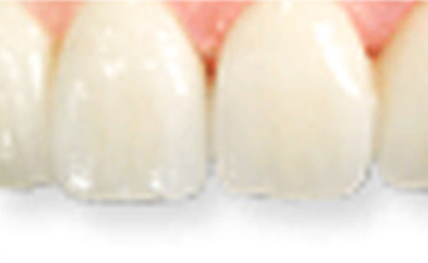 cosmetic-dentistry img 03