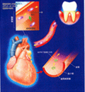 periodontal-procedures img 02