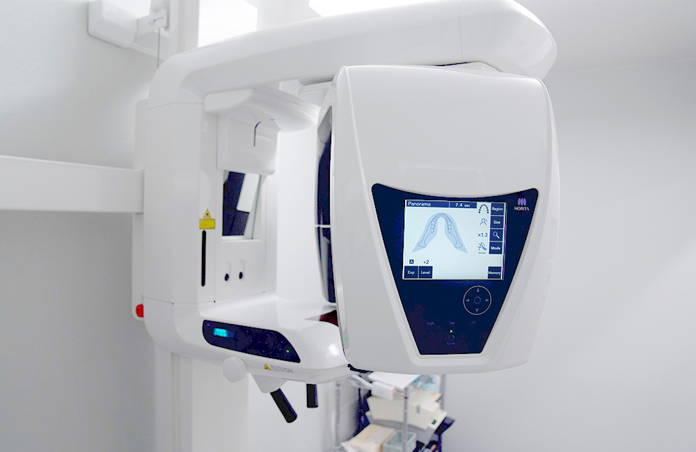 teeth_whitening img 02